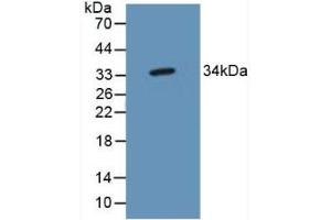 Detection of TP53TG5 in Mouse Brain Tissue using Polyclonal Antibody to TP53 Target Gene 5 (TP53TG5)