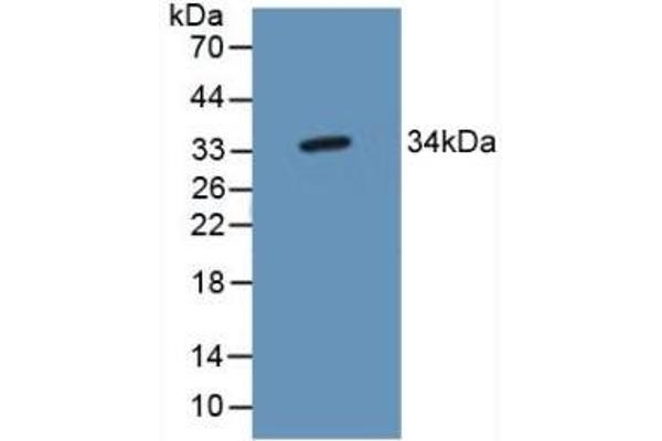 TP53TG5 Antikörper  (AA 190-262)