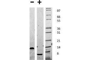 SDS-PAGE (SDS) image for Epidermal Growth Factor (EGF) protein (ABIN6699799)