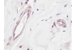 Image no. 1 for anti-Vascular Endothelial Growth Factor A (VEGFA) antibody (ABIN465403) (VEGFA antibody)