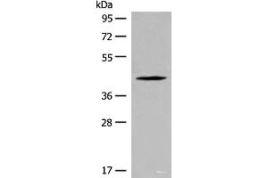 Western blot analysis of Jurkat cell lysate using QTRT1 Polyclonal Antibody at dilution of 1:450 (QTRT1 antibody)