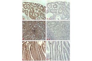 Immunohistochemical staining of of human tissue using anti-DLL1 (human), pAb  at 1:500 dilution.