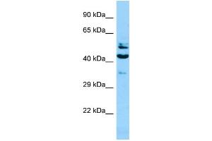 WB Suggested Anti-SH2D4A Antibody Titration: 1.