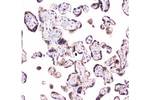 IHC analysis of CLPX using anti-CLPX antibody . (CLPX antibody  (AA 337-574))