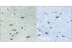 Immunohistochemistry analysis of paraffin-embedded human brain tissue, using IGF1R (Ab-1346) Antibody. (IGF1R antibody  (AA 1311-1360))