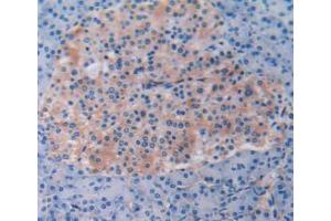 IHC-P analysis of Human Pancreas Tissue, with DAB staining. (Beclin 1 antibody  (AA 1-273))