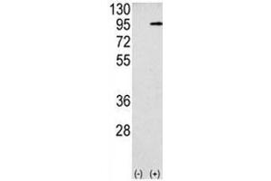 Western blot analysis APP antibody and 293 cell lysate (2 ug/lane) either nontransfected (Lane 1) or transiently transfected with the APP gene (2).