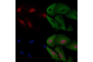 ABIN6257335 and ABIN6274168 staining  cells by IF/ICC. (MYF5 antibody  (N-Term))