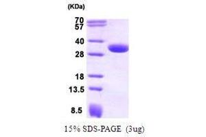 Figure annotation denotes ug of protein loaded and % gel used. (CBR1 Protein (AA 1-277))