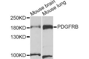 Western blot analysis of extracts of various cell lines, using PDGFRB antibody (ABIN5971206) at 1/1000 dilution. (PDGFRB antibody)