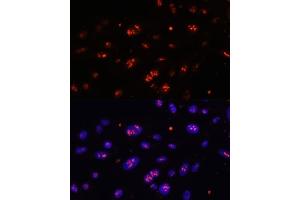 Immunofluorescence analysis of U-2 OS cells using DKC1 antibody (ABIN6127762, ABIN6139635, ABIN6139636 and ABIN6216722) at dilution of 1:100.