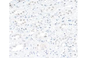 Immunohistochemistry (IHC) image for anti-ATP-Dependent RNA Helicase A (DHX9) (AA 200-250) antibody (ABIN7454523) (DHX9 antibody  (AA 200-250))