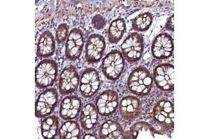 Immunohistochemical staining of human colon with TMC5 polyclonal antibody  shows moderate cytoplasmic, membranous and nuclear positivity in glandular cells at 1:50-1:200 dilution. (Tmc5 antibody)