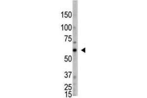 Western Blotting (WB) image for anti-2'-5'-Oligoadenylate Synthetase-Like (OASL) antibody (ABIN3002561)