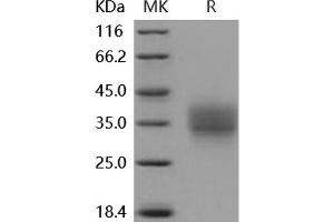 FZD1 Protein (His tag)