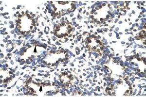Human Lung (PRDM14 antibody  (Middle Region))