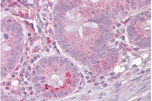 Immunohistochemistry with Small intestine tissue at an antibody concentration of 5µg/ml using anti-SLC13A2 antibody (ARP43864_P050) (SLC13A2 antibody  (Middle Region))