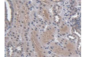 DAB staining on IHC-P; Samples: Human Kidney Tissue (Regucalcin antibody  (AA 65-299))
