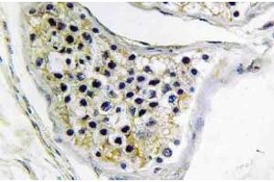 Immunohistochemistry (IHC) analyzes of CNOT4 antibody in paraffin-embedded human testis tissue.