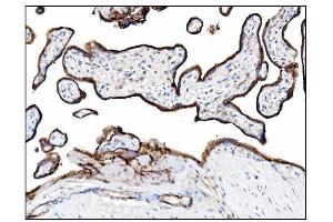 IHC analysis of CD39/ENTPD1 using anti-CD39/ENTPD1 antibody (ABIN7602461). (CD39 antibody  (AA 79-411))