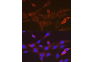 Immunofluorescence analysis of NIH-3T3 cells using T Rabbit mAb (ABIN7270916) at dilution of 1:100 (40x lens). (TACC3 antibody)