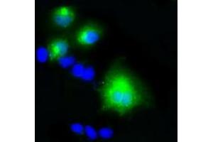 Anti-LIPG mouse monoclonal antibody (ABIN2453255) immunofluorescent staining of COS7 cells transiently transfected by pCMV6-ENTRY LIPG (RC209248). (LIPG antibody)