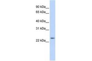 Image no. 1 for anti-RAB8A, Member RAS Oncogene Family (RAB8A) (C-Term) antibody (ABIN6741500) (RAB8A antibody  (C-Term))