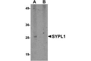 Western blot analysis of SYPL1 in human brain tissue lysate with this product at 1 μg/ml in (A) the absence and (B) the presence of blocking peptide. (SYPL1 antibody  (N-Term))