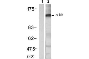 Western blot analysis of extract from A431 cell treated with EGF (200ng/ml, 30min), using c-Kit (Ab-721) Antibody (E021232, Lane 1 and 2). (KIT antibody)