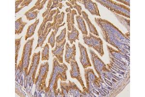 IHC analysis of PYROXD1 using anti-PYROXD1 antibody (ABIN6719650). (PYROXD1 antibody  (AA 48-230))