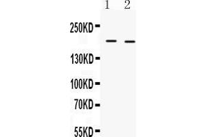 Western blot analysis of Collagen I expression in mouse kidney extract ( Lane 1) and mouse cardiac muscle extract ( Lane 2). (COL1A1 antibody  (C-Term))