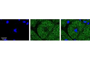 Rabbit Anti-PDK3 Antibody    Formalin Fixed Paraffin Embedded Tissue: Human Adult heart  Observed Staining: Cytoplasmic Primary Antibody Concentration: 1:100 Secondary Antibody: Donkey anti-Rabbit-Cy2/3 Secondary Antibody Concentration: 1:200 Magnification: 20X Exposure Time: 0. (PDK3 antibody  (N-Term))