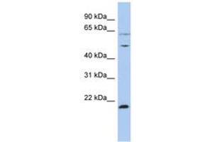Image no. 1 for anti-Proteasome (Prosome, Macropain) 26S Subunit, ATPase, 2 (PSMC2) (N-Term) antibody (ABIN6742450) (PSMC2 antibody  (N-Term))