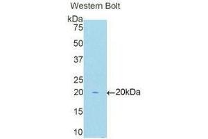 Western Blotting (WB) image for anti-Protein L-Myc (MYCL) (AA 257-394) antibody (ABIN1171696) (LMYC antibody  (AA 257-394))