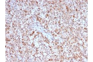 Immunohistochemistry (IHC) image for anti-CD40 Ligand (CD40LG) (AA 108-261) antibody (ABIN6941189)