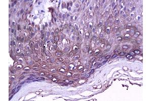 Formalin-fixed and paraffin embedded rat skin tissue labeled Anti-PPAR-delta Polyclonal Antibody, Unconjugated (ABIN726845) at 1:200 followed by conjugation to the secondary antibody and DAB staining (PPARD antibody  (AA 2-100))