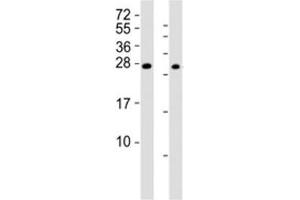 Western blot testing of RHOXF1 antibody at 1:2000; Lane 1: A2058 cell lysate, Lane 2: human ovary lysate. (RHOXF1 antibody  (AA 85-120))