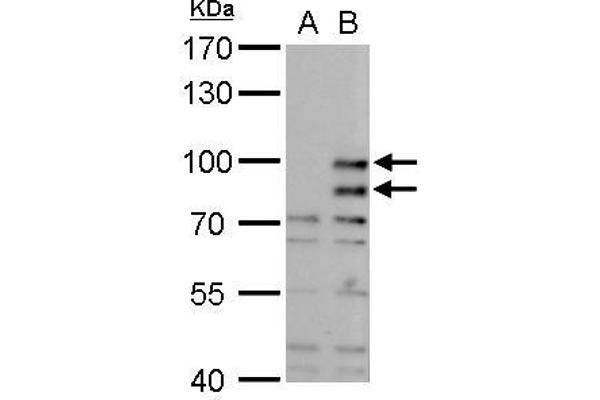 MDM2 antibody  (Center)