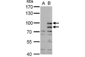 MDM2 anticorps  (Center)