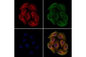 ABIN7094644 and ABIN7098694 staining Hela cells by IF/ICC. (Plastin 3 antibody  (Internal Region))