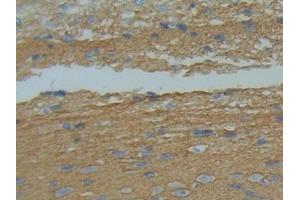 IHC-P analysis of Rat Brain Tissue, with DAB staining. (GAP43 antibody  (AA 8-226))