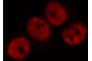 ABIN6269171 staining Hela by IF/ICC. (JunD antibody)