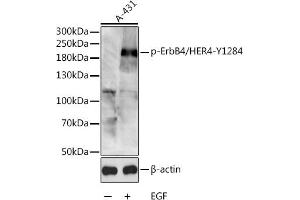 Western blot analysis of extracts of A-431 cells, using Phospho-ErbB4/HER4-Y1284 antibody (ABIN3023534, ABIN3023535, ABIN3023536 and ABIN6225393) at 1:1000 dilution. (ERBB4 antibody  (pTyr1284))