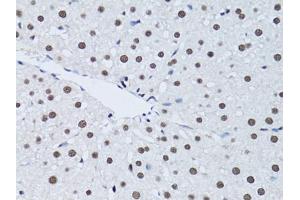 Immunohistochemistry of paraffin-embedded rat liver using PCNA antibody (ABIN1874056) at dilution of 1:100 (40x lens). (PCNA antibody)