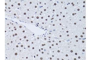Immunohistochemistry of paraffin-embedded rat liver using PCNA antibody (ABIN1874056) at dilution of 1:100 (40x lens).