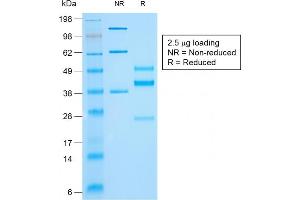 SDS-PAGE Analysis of Purified Cytokeratin 10 Mouse Recombinant Monoclonal Antibody (rKRT10/844). (Recombinant Keratin 10 antibody)
