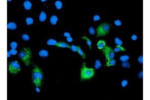 Image no. 3 for anti-Carboxypeptidase A2 (Pancreatic) (CPA2) antibody (ABIN1497594) (Carboxypeptidase A2 antibody)