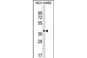 ZN Antibody (Center) (ABIN1537874 and ABIN2849918) western blot analysis in NCI- cell line lysates (35 μg/lane). (ZNF488 antibody  (AA 149-175))