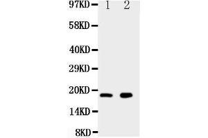 Anti-Ly6al antibody, Western blotting Lane 1: Rat Cardiac Muscle Tissue Lysate Lane 2: Rat Liver Tissue Lysate (LY6AL antibody  (AA 91-108))