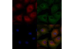 ABIN6265163 and ABIN6272472 staining  cells by IF/ICC. (Transgelin antibody  (C-Term))